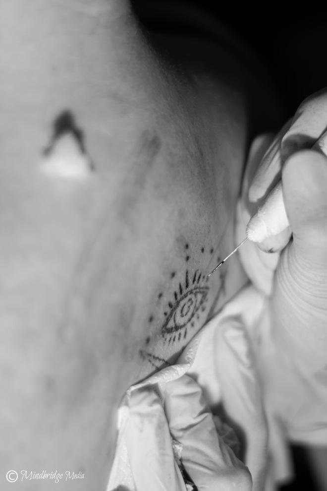 Needle and tattoo